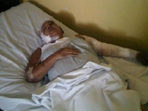 Dominga Vizcaíno, de 45 años, fue operada de emergencia en el “Centro Clínico San Cristóbal”, donde se informó que su estado era delicado al recibir heridas punzantes en el cráneo y otras parte del cuerpo.
