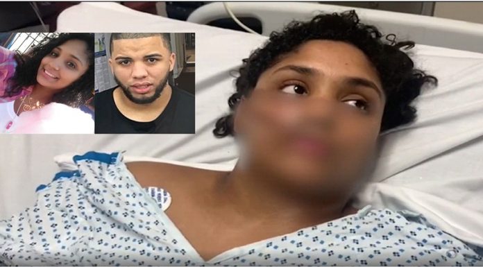 Dominicana atacada a machetazos por ex pareja confirma le retiró orden de alejamiento porque él actuaba normal