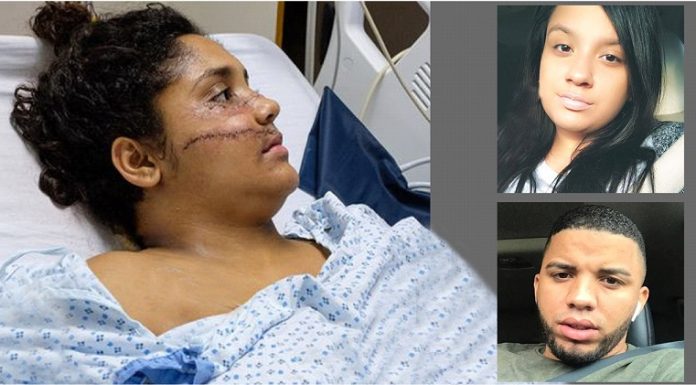 Se declara culpable por intento de asesinato y otros cargos dominicano que atacó a machetazos a ex pareja en El Bronx