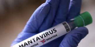 OMS: Hantavirus sólo se transmite por contacto estrecho, con posible exposición a saliva